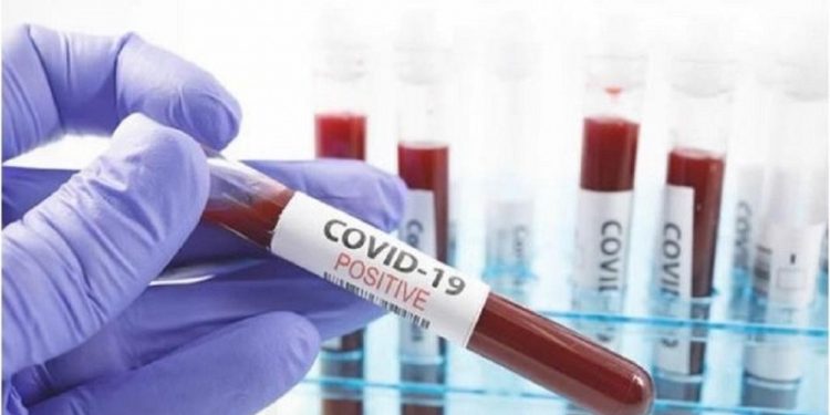 Covid-19 : 116 nouveaux cas détectés, 5 nouvelles personnes guéries et aucun décès ( Cumul 2141)