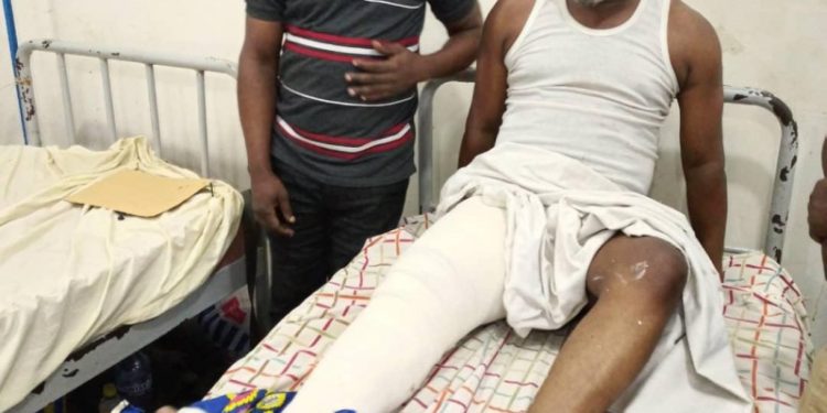 Kinshasa : le secrétaire général de MPASA amputé de sa jambe après son kidnapping et passage au tabac